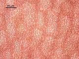 3 - Cellule corticali in visione superficiale